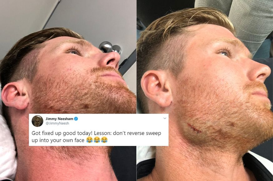 Ouch: Kiwi All-Rounder Jimmy Neesham Learns Reverse the Hard Way